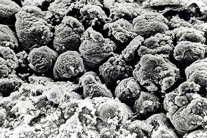 Leaky gut showing blunt ended villi, villi fusion, debris in the lumen and more space between the intestinal cells. Photo: Impextraco Leaky gut showing blunt ended villi, villi fusion, debris in the lumen and more space between the intestinal cells. Photo: Impextraco