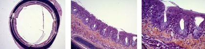 Score 1: Light inflammatory lesions. Spots of lymphocytes and plasmocytes. Light congestion. Score 1: Light inflammatory lesions. Spots of lymphocytes and plasmocytes. Light congestion.