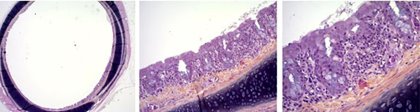 Score 2: Moderate inflammatory lesions. Lymphocytes and plasmocytes invasion inducing thickening spots around the trachea wall. Score 2: Moderate inflammatory lesions. Lymphocytes and plasmocytes invasion inducing thickening spots around the trachea wall.