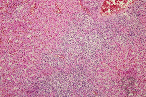 Poultry award highlights Marek s disease research