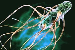 Salmonella fears may prompt Russian ban of US poultry