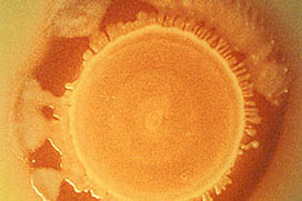 A large colony of Salmonella enteritidis. ARS scientists have developed an improved way to identify various strains of this bacterium.