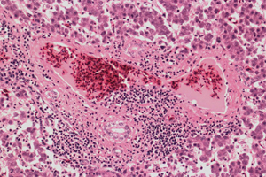 Avian hepatitis-E-virus infection in chickens - Part 2