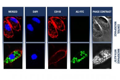 Figure 1 - Beta-(1,3)-glucan (green) is recognised and phagocytosed by macrophages (red =surface, blue=nucleus), a must to induce an immune modulating effect. Source: Kemin