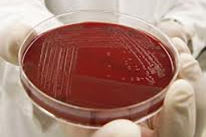 Campylobacter research reveals potential for vaccine