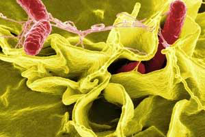 Fowl typhoid strikes layer farm in Northern Ireland
