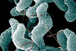 US Study: Campylobacter in poultry processing workers
