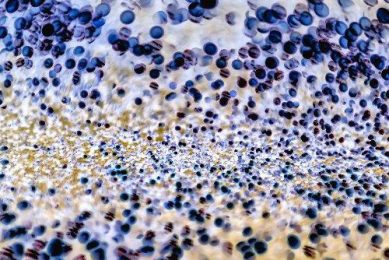 Waste in the gut: Peptidoglycans of bacterial origin. Photo: DSM