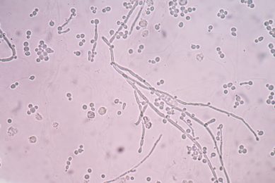Yeast s potential as an AGP alternative. Photo: Shutterstock