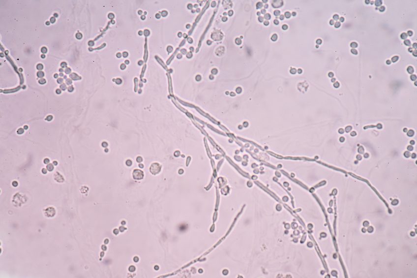 Yeast s potential as an AGP alternative. Photo: Shutterstock