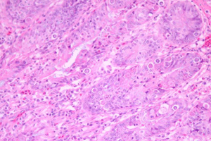 Breakthrough in fight against deadly chicken disease