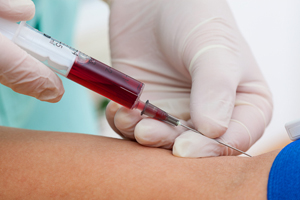 Blood samples to be taken at UK poultry show