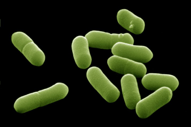 Water treatment plants a hot spot for resistant bacteria