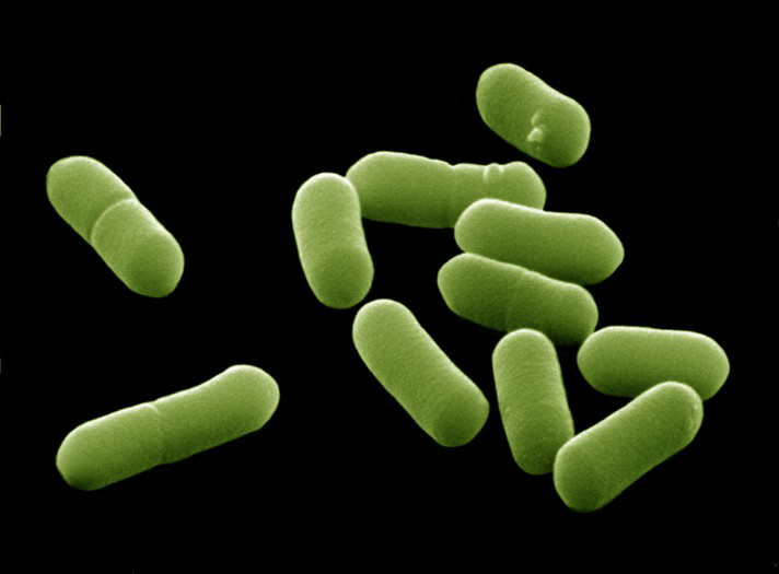 Water treatment plants a hot spot for resistant bacteria