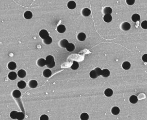 Selenium deficiency stops Campylobacter gut colonisation