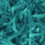 Firm recalls turkey products for possible Listeria contamination