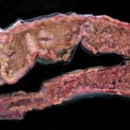 Poultry killing toxin falsely accused