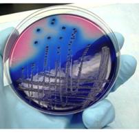 Cancer vaccine based on Listeria