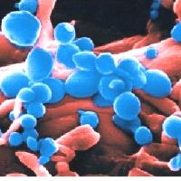 Pakistan: WHO experts check for human-to-human H5N1 transmission