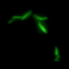 Nanotechnology biosensor to detect Salmonella