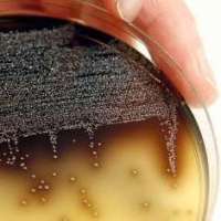 CFIA to release stricter listeria rules