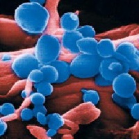 China reports H5N1 outbreak