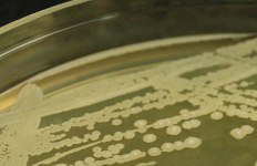 Bacillus strain fights Clostridial infections