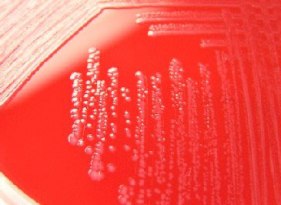 Enterococcus cecorum most found in broilers