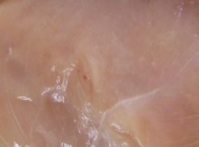 Tracing Listeria monocytogenes in commercial chicken plant