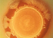 Genetic screening technique detects antimicrobial-resistance genes