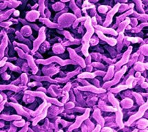 EFSA issues advice on reduction of  Campylobacter in chickens
