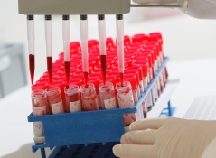 Genomic selection brings more genetic progress