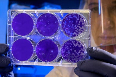 According to Professor Moreno from the University of Sao Paulo, the constant monitoring of key pathogens such as Salmonella involving animal and human populations is extremely important to comprehend the effect of prevention and control programmes implemented in a specific population. Photo: CDC