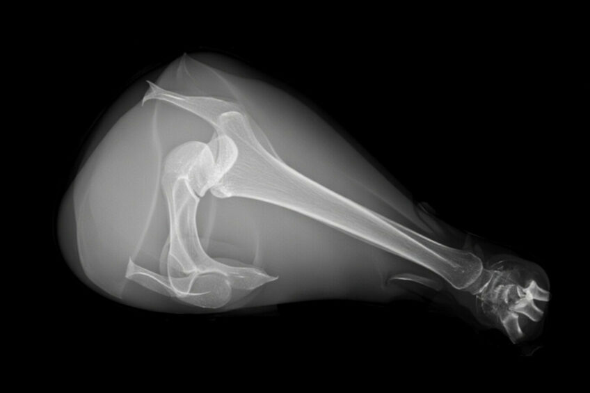 Researchers say that a standard digital X‑ray, analysed end‑to‑end, can produce a genetically informative, scalable measure of tibial strength that beats manual image metrics. Image created with the help of AI (Reve)